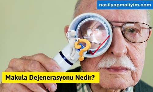 Makula Dejenerasyonu Nedir? Sebepleri, Belirtileri ve Tedavi Yöntemleri